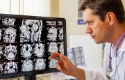 MS Brain Changes