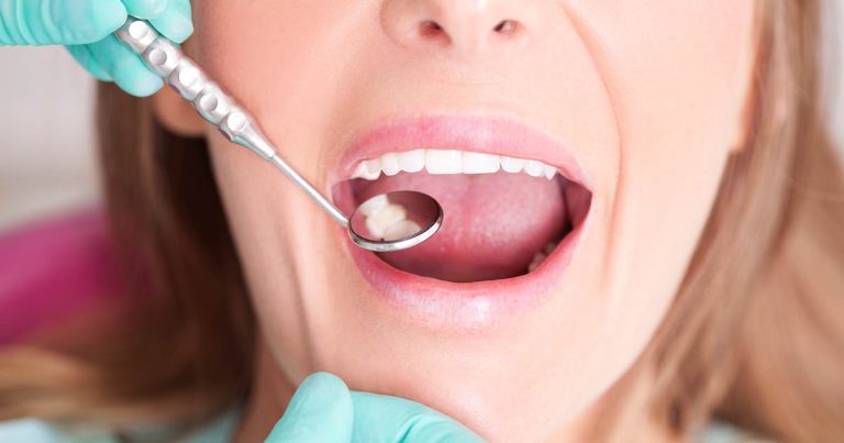 ms and dental issues