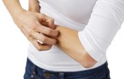 MS and Itchy Skin
