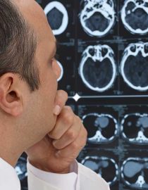 Multiple Sclerosis vs. Parkinson’s: Similarities and Differences Multiple Sclerosis vs. Parkinson’s: Similarities and Differences